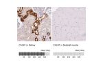 Immunohistochemistry analysis in human kidney and skeletal muscle tissues using HPA023099 antibody. Corresponding CALB1 RNA-seq data are presented for the same tissues.