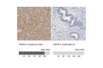 Immunohistochemistry analysis in human cerebral cortex and endometrium tissues using HPA023138 antibody. Corresponding NEFM RNA-seq data are presented for the same tissues.