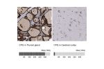 Immunohistochemistry analysis in human thyroid gland and cerebral cortex tissues using Anti-CPQ antibody. Corresponding CPQ RNA-seq data are presented for the same tissues.