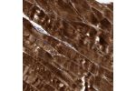 Immunohistochemical staining of human skeletal muscle shows strong cytoplasmic positivity in myocytes.