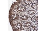Immunohistochemical staining of human rectum shows strong cytoplasmic positivity in granular pattern in glandular cells.