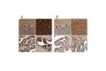 Immunohistochemical staining of human cerebellum, cerebral cortex, fallopian tube and prostate using Anti-BAIAP2 antibody HPA023310 (A) shows similar protein distribution across tissues to independent antibody HPA027421 (B).