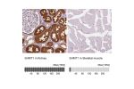 Immunohistochemistry analysis in human kidney and skeletal muscle tissues using HPA023314 antibody. Corresponding SHMT1 RNA-seq data are presented for the same tissues.
