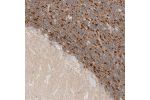 Immunohistochemical staining of human cerebellum shows strong cytoplasmic positivity in granular layer cells.