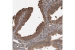 Immunohistochemical staining of human endometrium shows moderate cytoplasmic positivity in glandular cells.