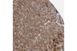 Immunohistochemical staining of human pancreas shows distinct cytoplasmic positivity in exocrine cells.