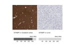 Immunohistochemistry analysis in human cerebral cortex and liver tissues using HPA023483 antibody. Corresponding STXBP1 RNA-seq data are presented for the same tissues.