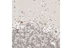 Immunohistochemical staining of human cerebellum shows moderate to strong positivity in nuclear speckles in Purkinje cells.
