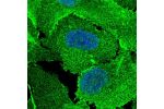Immunofluorescent staining of human cell line U-2 OS shows localization to nucleoplasm, plasma membrane & cell junctions.