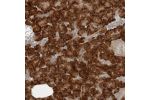 Immunohistochemical staining of human pancreas shows strong cytoplasmic positivity in exocrine glandular cells.