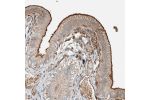 Immunohistochemical staining of human gall bladder shows distinct membranous and cytoplasmic positivity in glandular cells.