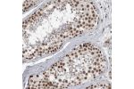 Immunohistochemical staining of human testis shows strong nuclear positivity in cells in seminiferous ducts.