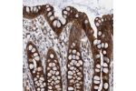 Immunohistochemical staining of human rectum shows strong cytoplasmic positivity in glandular cells.