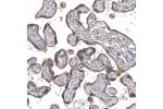 Immunohistochemical staining of human placenta shows moderate cytoplasmic positivity in trophoblastic cells.