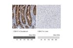 Immunohistochemistry analysis in human duodenum and liver tissues using HPA023616 antibody. Corresponding CDH17 RNA-seq data are presented for the same tissues.