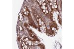 Immunohistochemical staining of human rectum shows strong cytoplasmic and membranous positivity in granular pattern in glandular cells.