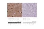 Immunohistochemistry analysis in human cerebral cortex and liver tissues using HPA023629 antibody. Corresponding NECAB1 RNA-seq data are presented for the same tissues.
