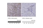 Immunohistochemistry analysis in human adrenal gland and skeletal muscle tissues using HPA023644 antibody. Corresponding STAR RNA-seq data are presented for the same tissues.