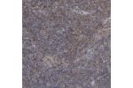 Immunohistochemical staining of human tonsil shows mdoerate cytoplasmic positivity in non-germinal center cells.