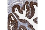 Immunohistochemical staining of human fallopian tube shows strong cytoplasmic and membranous positivity in glandular cells.