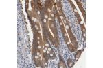 Immunohistochemical staining of human lymph node shows moderate cytoplasmic positivity in germinal centers.
