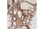 Immunohistochemical staining of human thyroid gland shows strong cytoplasmic positivity with a granular pattern in glandular cells.