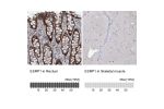 Immunohistochemistry analysis in human rectum and skeletal muscle tissues using HPA023719 antibody. Corresponding ESRP1 RNA-seq data are presented for the same tissues.