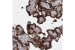 Immunohistochemical staining of human placenta shows strong cytoplasmic positivity in trophoblastic cells.