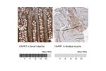 Immunohistochemistry analysis in human small intestine and skeletal muscle tissues using HPA023739 antibody. Corresponding NAPRT RNA-seq data are presented for the same tissues.
