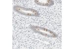 Immunohistochemical staining of human endometrium shows moderate cytoplasmic positivity in ciliated glandular cells.