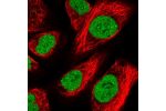 Immunofluorescent staining of human cell line A549 shows localization to nucleoplasm & nucleoli fibrillar center.