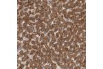 Immunohistochemical staining of human liver shows strong cytoplasmic positivity in hepatocytes.