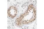 Immunohistochemical staining of human testis shows strong nuclear positivity in cells in seminiferous ducts.