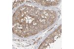 Immunohistochemical staining of human testis shows moderate cytoplasmic positivity in cells in seminiferous ducts.