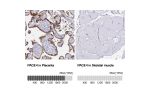 Immunohistochemistry analysis in human placenta and endometrium tissues using Anti-PAGE4 antibody. Corresponding PAGE4 RNA-seq data are presented for the same tissues.