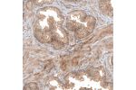 Immunohistochemical staining of human prostate shows moderate membranous and cytoplasmic positivity in smooth muscle cells and glandular cells.