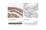 Immunohistochemistry analysis in human duodenum and testis tissues using HPA023884 antibody. Corresponding ADA RNA-seq data are presented for the same tissues.