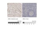 Immunohistochemistry analysis in human skeletal muscle and tonsil tissues using HPA023885 antibody. Corresponding DMD RNA-seq data are presented for the same tissues.