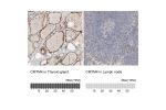 Immunohistochemistry analysis in human thyroid gland and lymph node tissues using Anti-CMTM4 antibody. Corresponding CMTM4 RNA-seq data are presented for the same tissues.