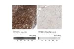 Immunohistochemistry analysis in human appendix and skeletal muscle tissues using Anti-NFKB2 antibody. Corresponding NFKB2 RNA-seq data are presented for the same tissues.