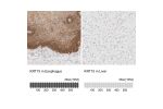 Immunohistochemistry analysis in human esophagus and stomach tissues using Anti-KRT15 antibody. Corresponding KRT15 RNA-seq data are presented for the same tissues.