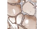 Immunohistochemical staining of human thyroid gland shows moderate cytoplasmic positivity in glandular cells.