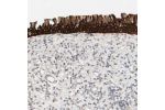 Immunohistochemical staining of human nasopharynx shows strong cytoplasmic positivity in respiratory epithelial cells.
