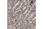 Immunohistochemical staining of human stomach shows strong nuclear membrane positivity in glandular cells.