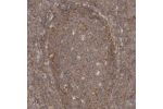 Immunohistochemical staining of human pancreas shows moderate cytoplasmic positivity in exocrine cells.