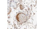 Immunohistochemical staining of human duodenum shows moderate positivity in plasma.