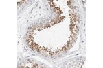 Immunohistochemical staining of human testis shows strong cytoplasmic positivity in seminiferous ducts cells.