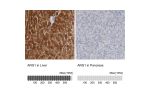 Immunohistochemistry analysis in human liver and pancreas tissues using Anti-ARG1 antibody. Corresponding ARG1 RNA-seq data are presented for the same tissues.