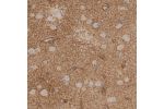 Immunohistochemical staining of human cerebral cortex shows strong cytoplasmic positivity in neuropil.