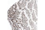 Immunohistochemical staining of human Cerebellum shows moderate nuclear positivity in Purkinje cells.